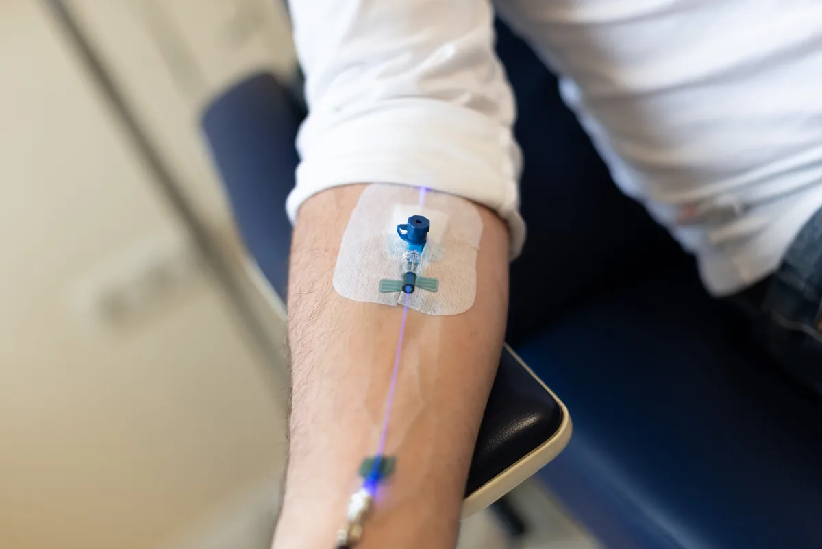 Close view of a cannula and blue-lit laser fibre taped to a forearm